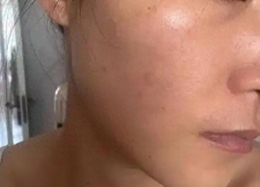 皮膚暗沉、長斑，美白秘籍大公開